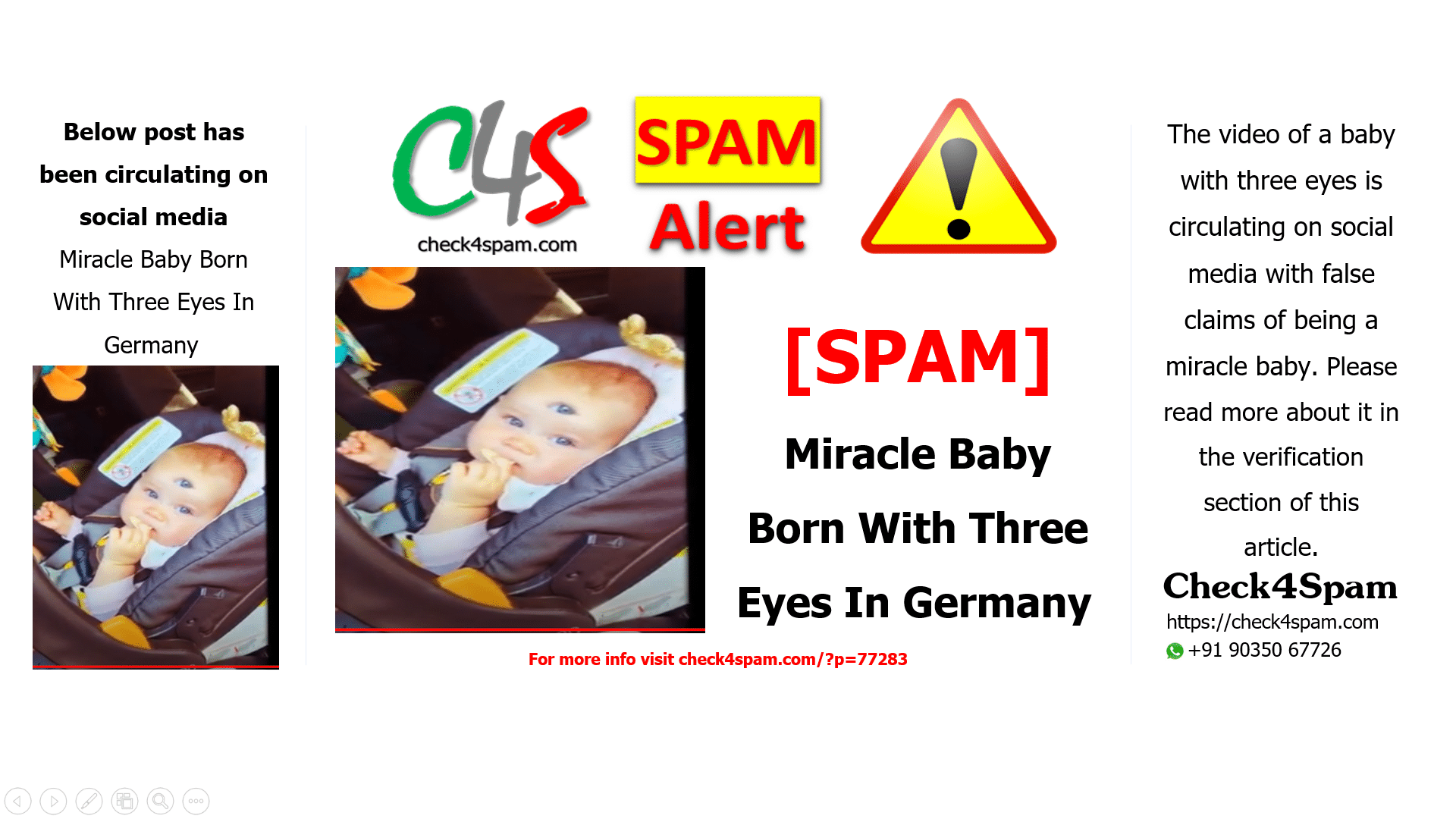 Miracle Baby Born With Three Eyes In Germany